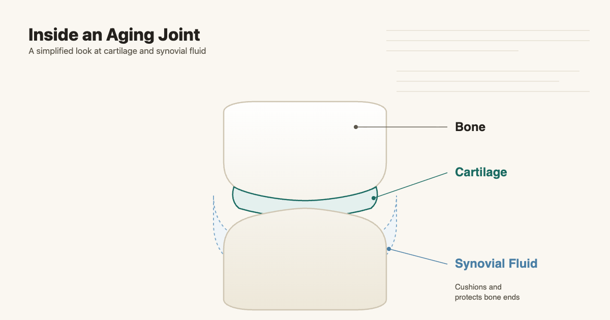 Diagram of a joint showing bone, cartilage, and synovial fluid